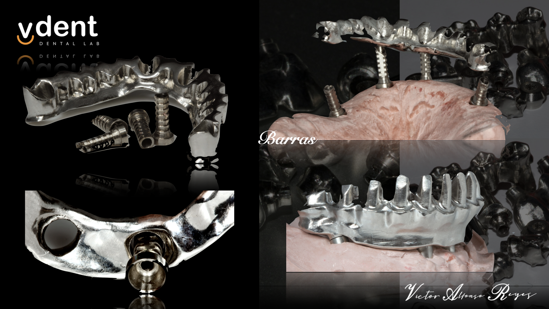 ESTRUCTURAS SOBRE IMPLANTES
