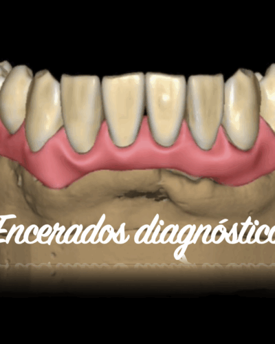 ENCERADOS DIAGNOSTICOS