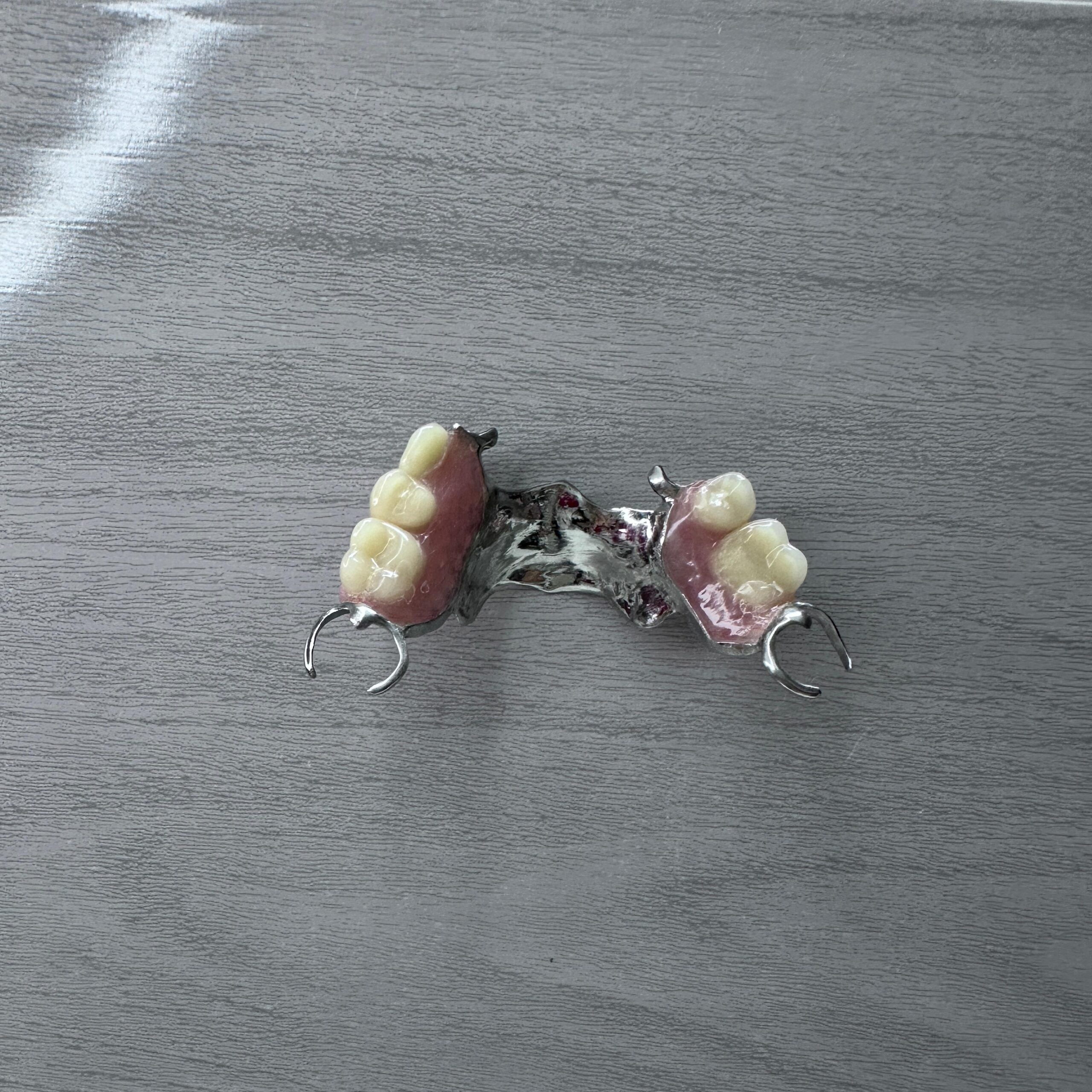 PROTESIS CON ESTRUCTURA METALICA